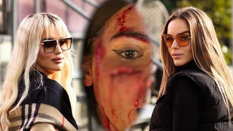 I çanë fytyrën duke i thyer shishen e qelqit në fytyrë Klea Prengës/ TIMS: Dy motrat Berisha s’janë larguar nga Shqipëria! Sekuestrohen dy mjete