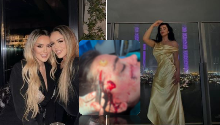 U dhunua nga motrat Berisha/ Klea Prenga me qepje në fytyrë reagon sërish: Akuza pa baza, ajo nuk ka burrë U dhunua nga motrat Berisha/ Klea Prenga me qepje në fytyrë reagon sërish: Akuza pa baza, ajo nuk ka burrë