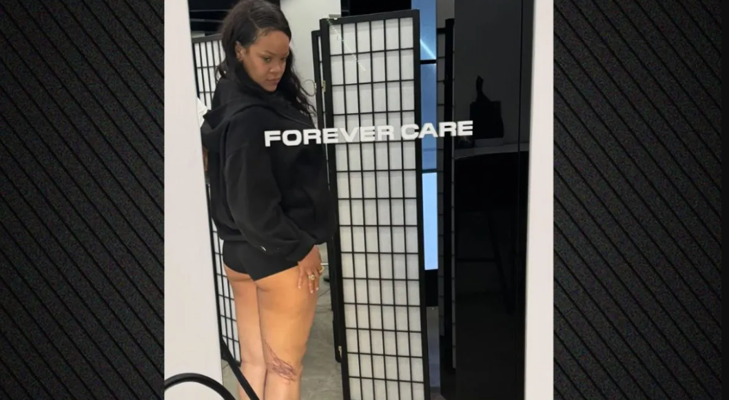 Nga letra në lëkurë! Rihanna kthen vizatimet e fëmijëve në tatuazh