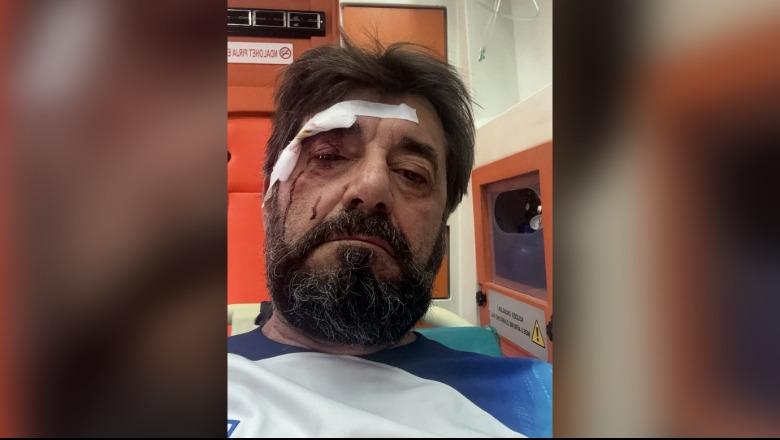 Sherr me fqinjin për gjobat e makinave nga policia, dhunohet analisti Ilir Demalia! Në kërkim autori Sherr me fqinjin për gjobat e makinave nga policia, dhunohet analisti Ilir Demalia! Në kërkim autori